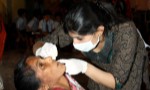 Tooth extraction